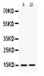 Anti-Apolipoprotein CIII Picoband Antibody